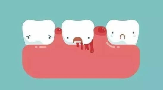 导致牙龈出血的主要因素有哪些