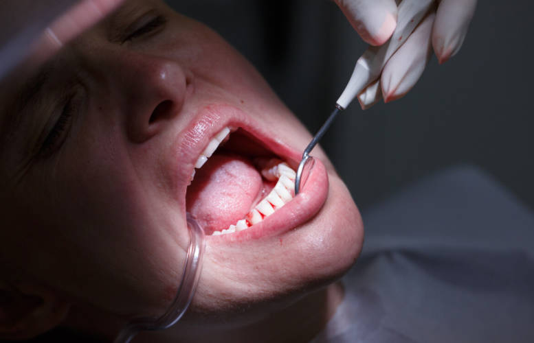 牙龈出血的危害有哪些?