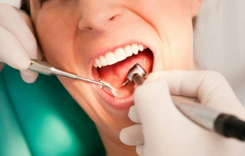 牙龈出血需要重视吗