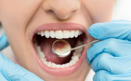 牙龈出血该如何有效的治疗