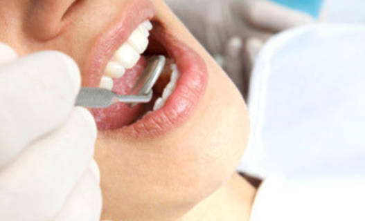 牙龈出血需要去做什么检查