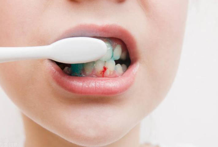 刷牙牙龈出血是什么原因？