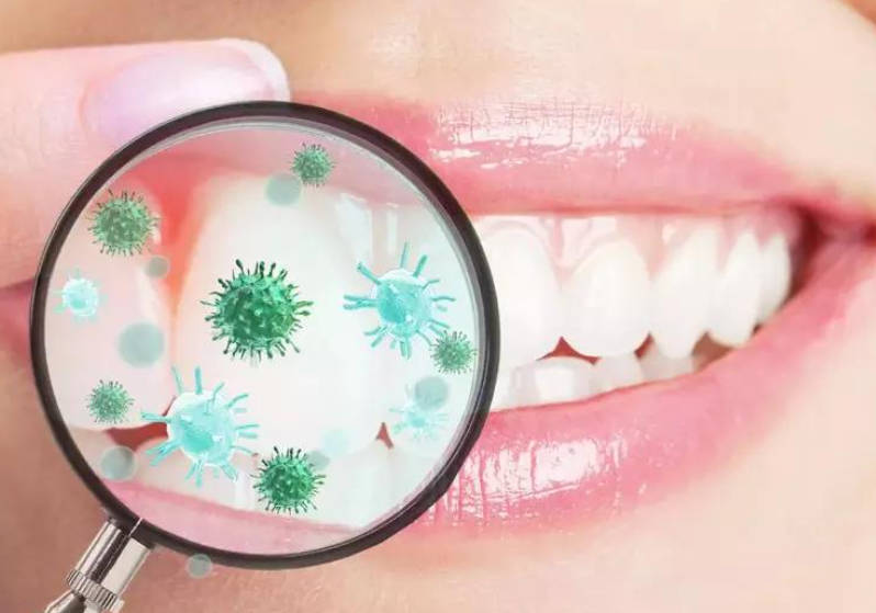 刷牙牙龈经常出血吃什么药?