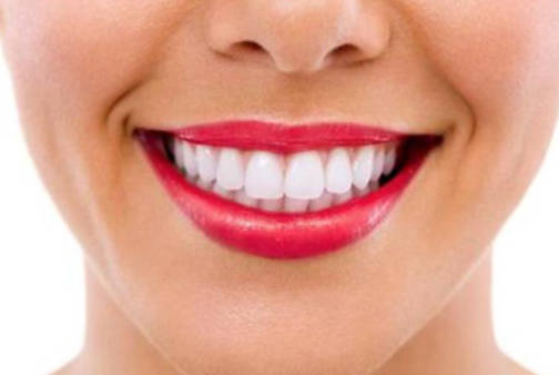 牙齿美白贴面多少钱?