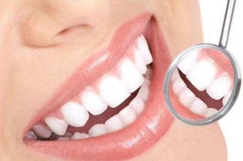 牙齿贴面的适应人群有哪些?