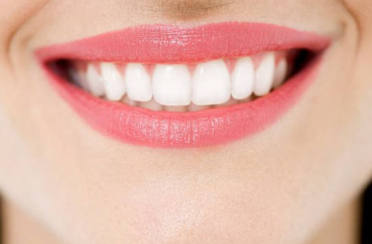 牙齿美白贴面是什么?