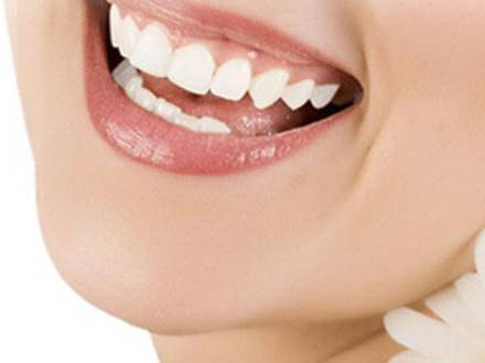 牙齿贴面是永久美白的吗?