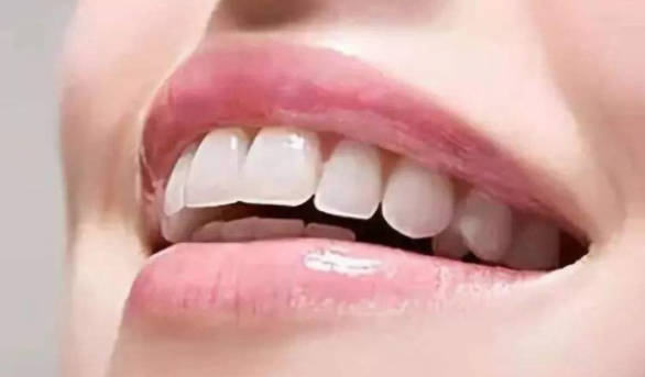 冷光美白牙齿效果明显吗?