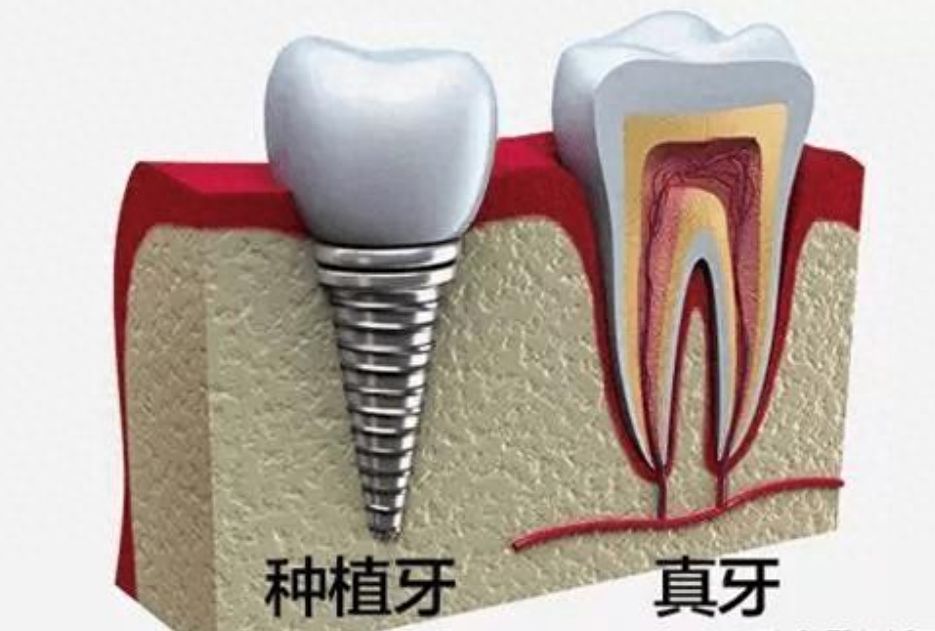 浙江大学附属口腔医院费用清单及服务详情：补牙、种牙价格实惠，一览表