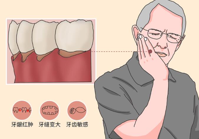 深圳岚世纪口腔：拔牙费用、杨恒锦医生简介全解析