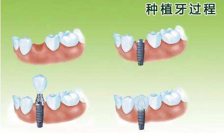 西宁地区有哪些知名口腔医院呢？