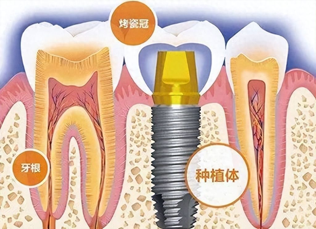 盘点恩施口碑好且实惠的3家牙科医院，整牙种牙一手包办！