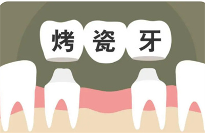 乌鲁木齐天牙口腔种植牙全解析：技术、价格、预约小技巧