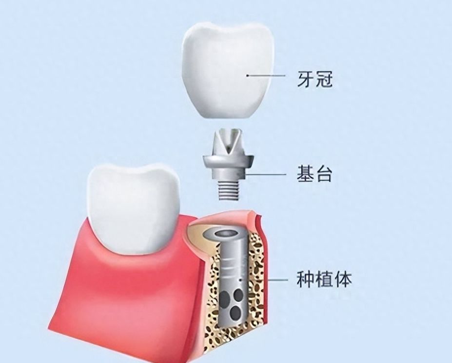 珠海暨博口腔医院：口腔问题解决方案揭秘