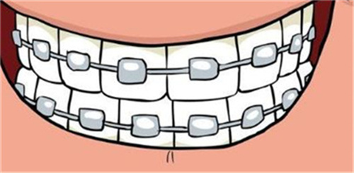 成都新桥口腔，为什么是牙齿矫正的不二选择？五大益处揭秘！