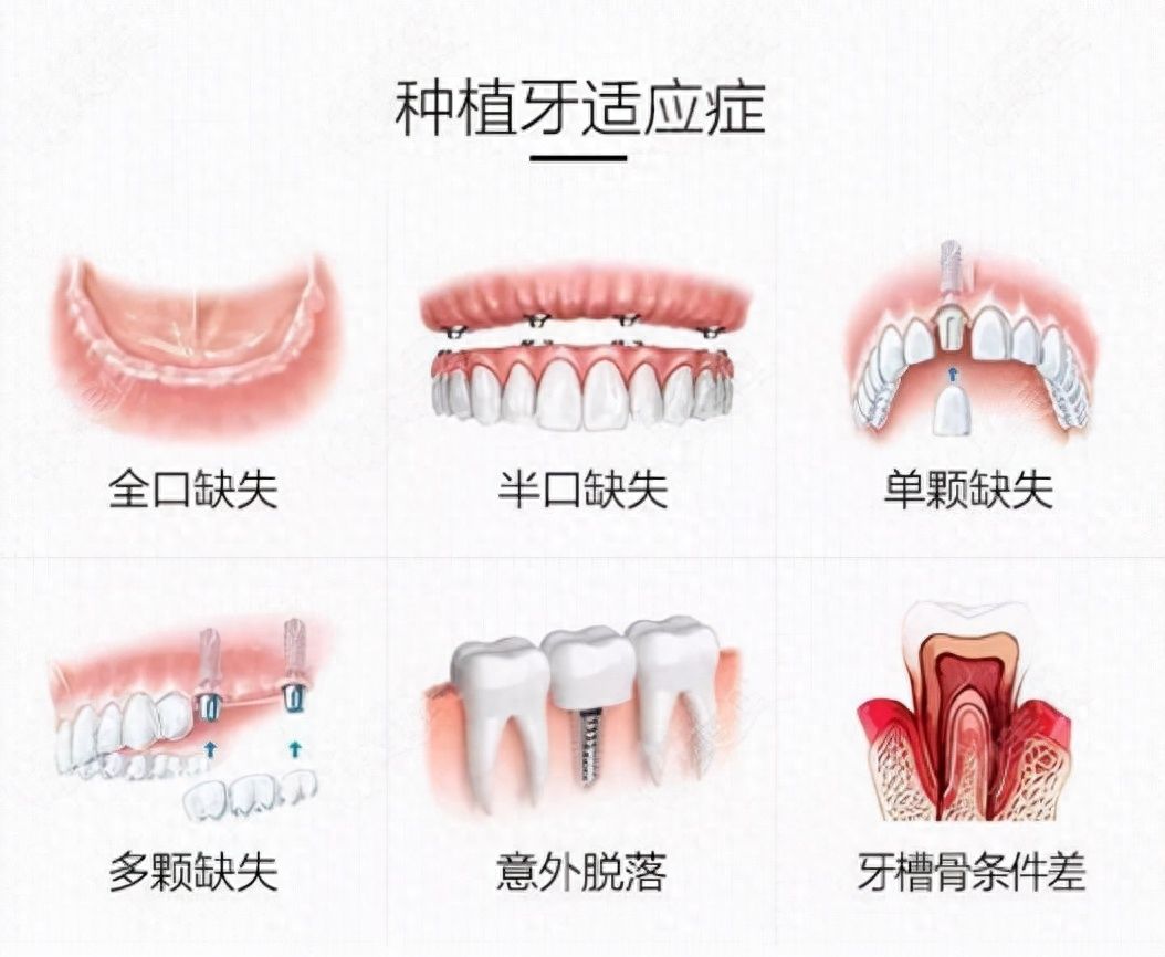 呼伦贝尔牙齿矫正哪家医院靠谱？参考呼和浩特正畸医院排行榜及价格