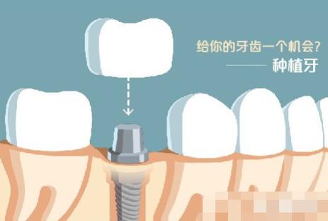梅州新城中大口腔门诊部：专业口腔医疗服务，让你拥有健康笑容！