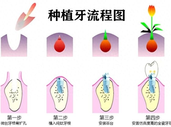 咸阳海涛口腔医院：地址、价格一览，种植牙拔牙更实惠