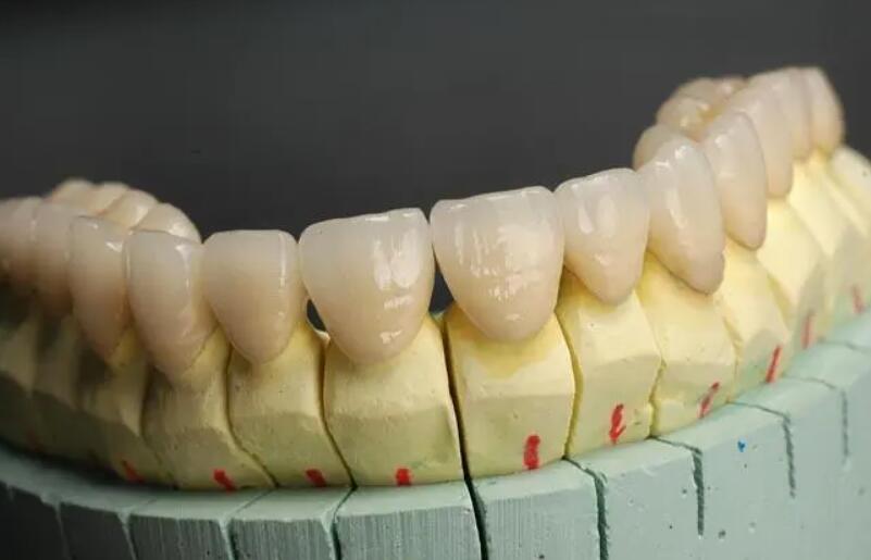 梅州哪家牙科医院口碑好？2024最新牙齿矫正价格解析