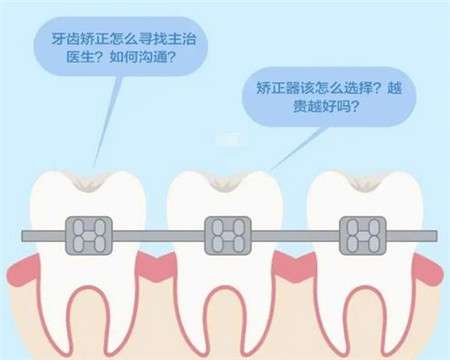 扬州牙科收费咨询汇总！洗牙、拔牙、种植牙、正畸价格解析！