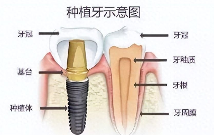 宁波恒美口腔：专业医师助您完美牙齿矫正