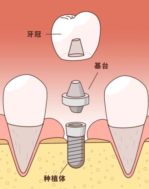 2024杭州滨江看牙指南：前十口腔医院大盘点