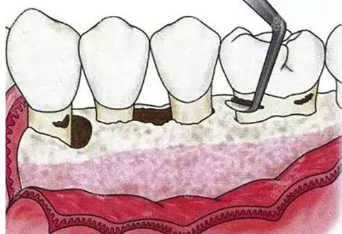 白银康乐口腔：正畸、拔牙、修复等服务靠谱可信！