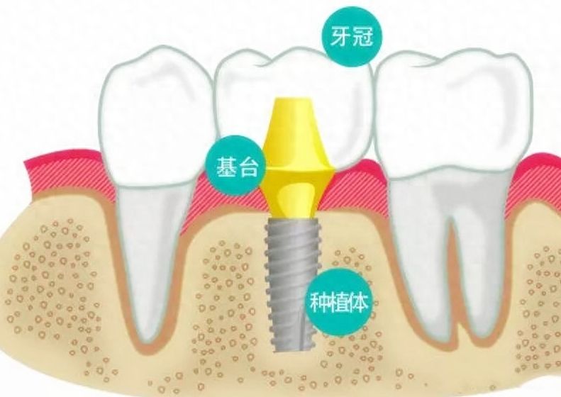 成都青羊唐牙科门诊部：价格表一览，专业口腔服务供您选择