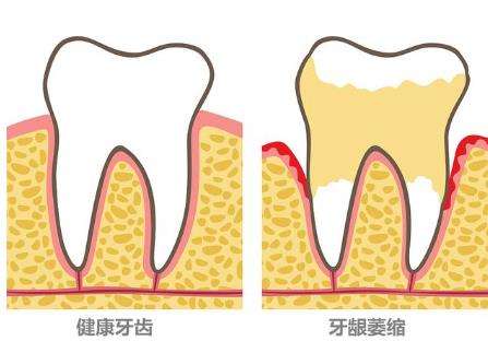 广州越秀区隐矫VS金矫 值得选择哪个呢