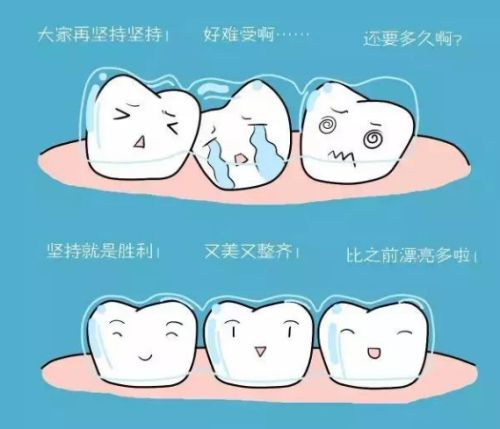 石家庄牙科价格大揭秘！牙齿矫正、种植牙收费一览