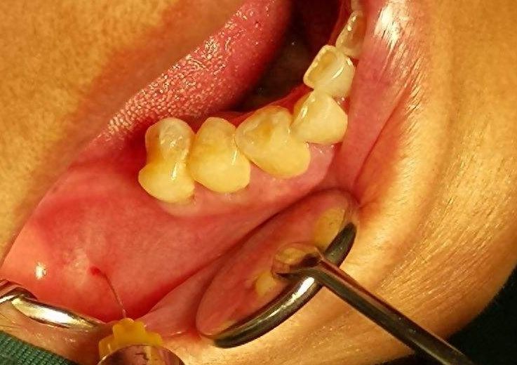 西安灞桥心牙口腔门诊部的用户口碑如何？