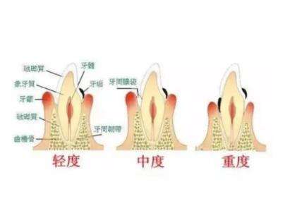 【口腔正畸】世纪金典门诊部：满足您理想微笑的首选