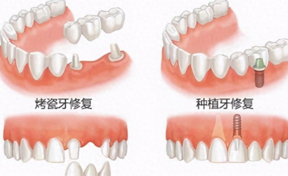 北京诚之康口腔：医院实力+口碑全面解析，你需要知道的一切