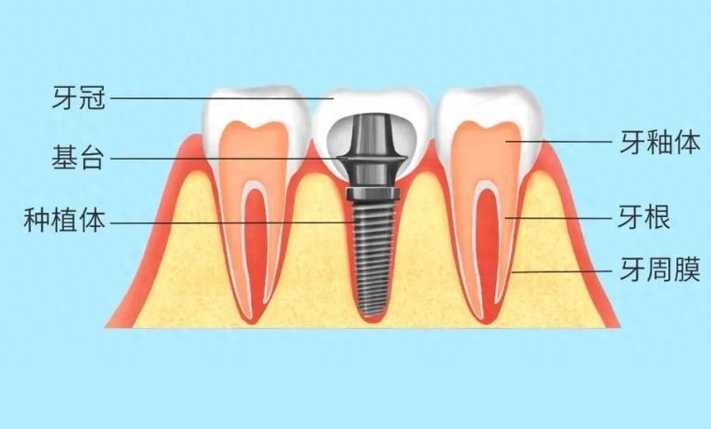 2024上海圣康口腔：整牙、种牙、牙贴面价格实惠！收费价目表更新！