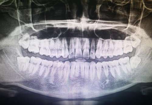 【特惠上线】成都茁悦口腔护齿充值活动，体验牙齿护理！